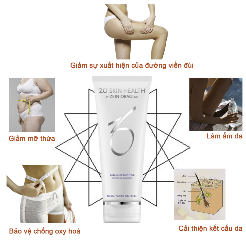 Kem tan mỡ cứng cục bộ Zo Skin Health Cellulite Control